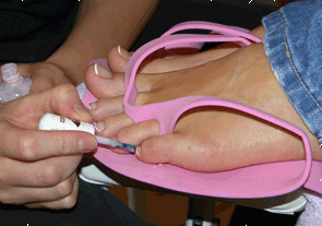Pedicure treatment